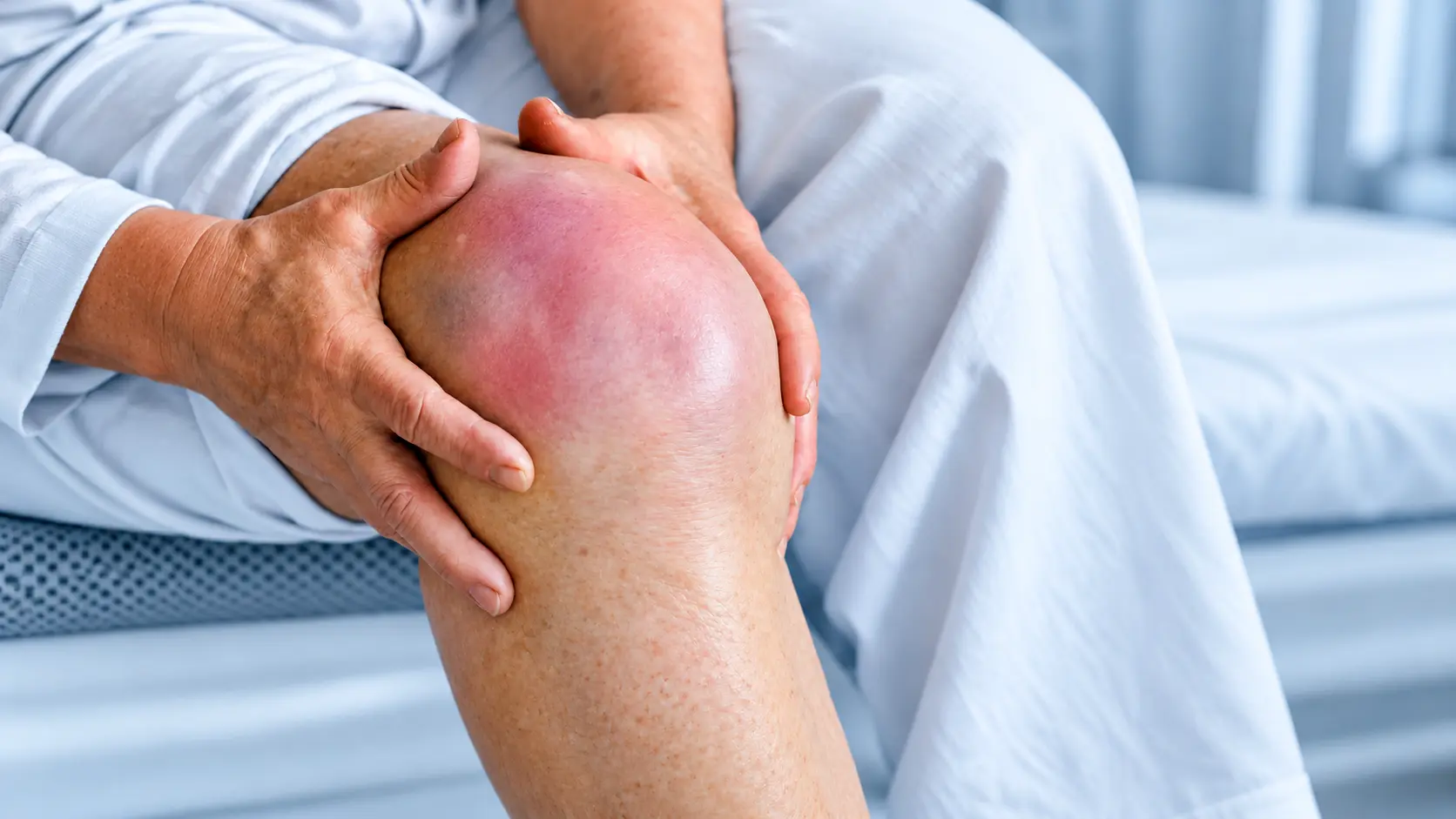 Why Does My Knee Swell After Walking? Could It Be Arthritis